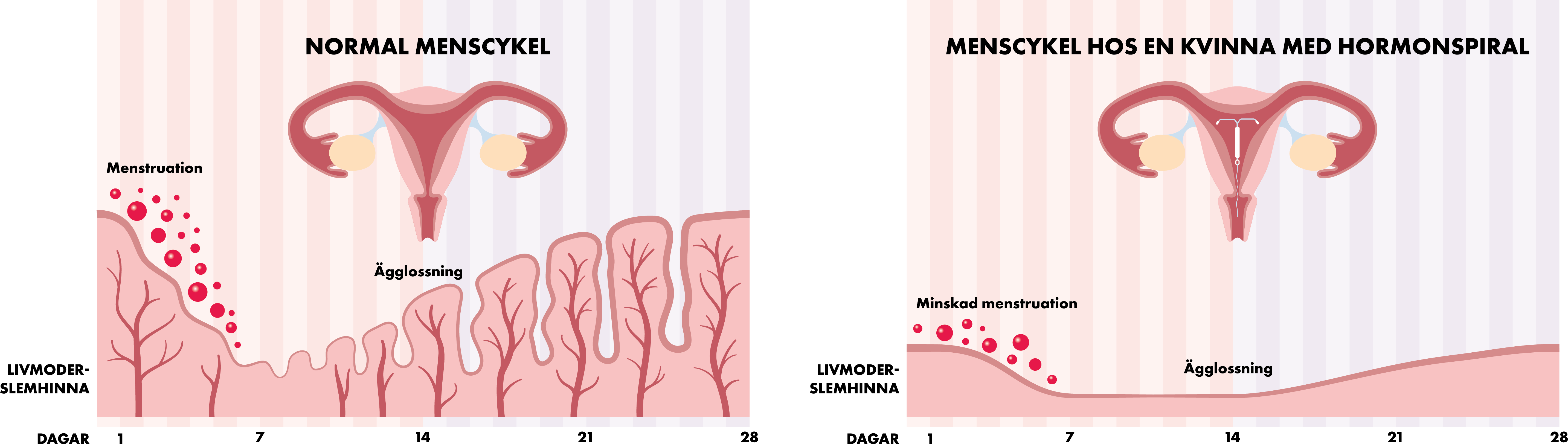 Bild: Menscykeln med och utan hormonspiral