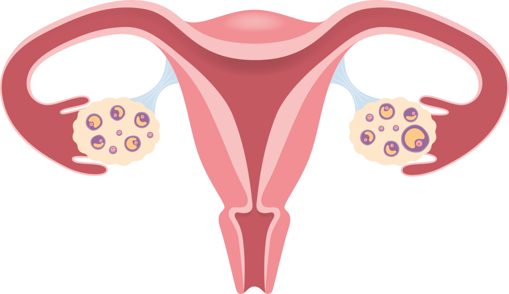 Bild: Livmoder med äggblåsor