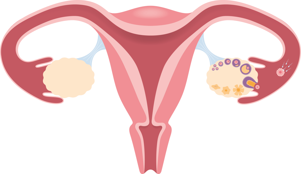 Bild: livmoder med ägglossning