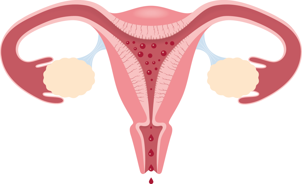 Bild: livmoder med mens.